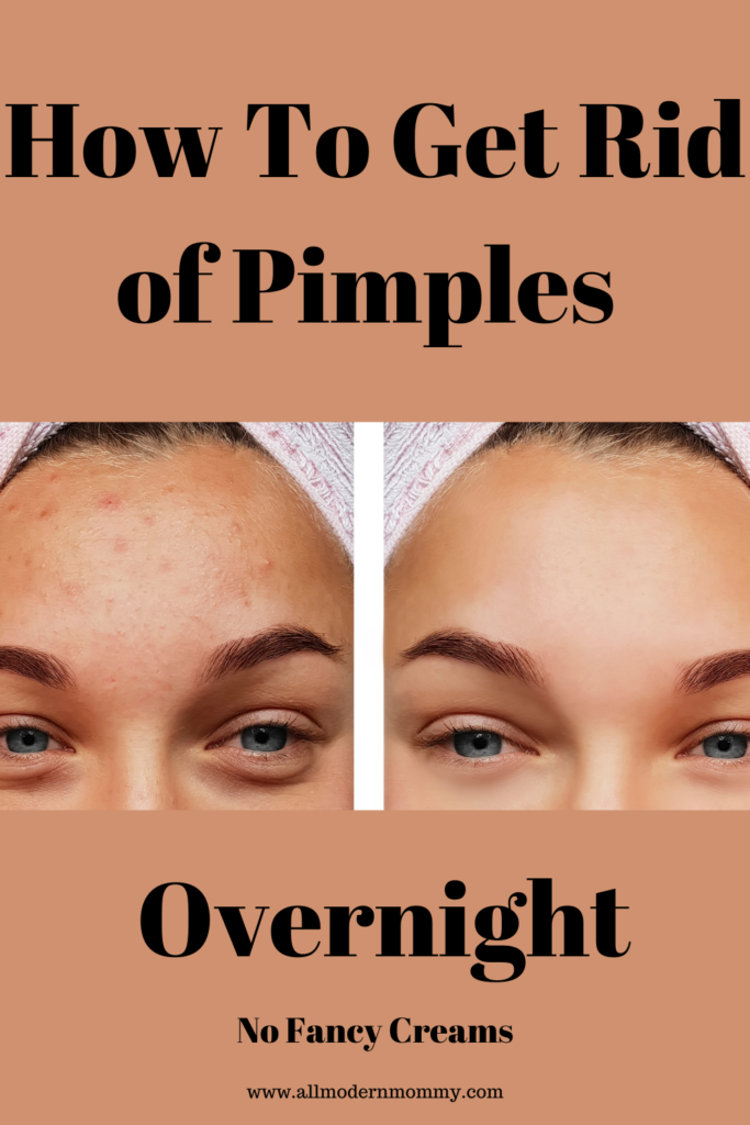 How To Get Rid Of Pimples Overnight