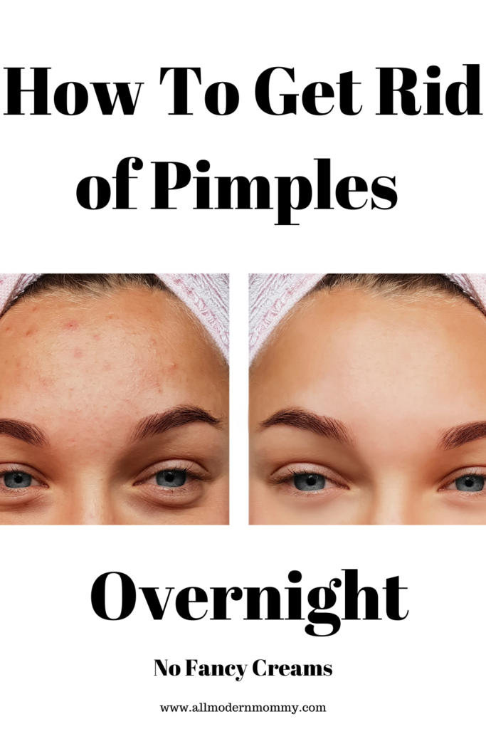 how-to-get-rid-of-pimples-overnight