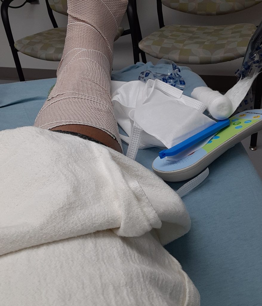 Tips To Heal a Broken Ankle (My Story)